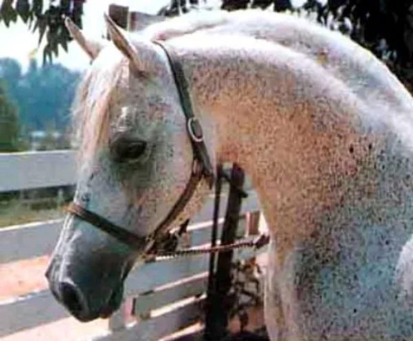 Ferseyn
