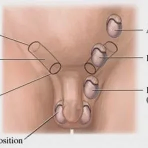 Cryptorchidism in Dogs (Retained Testes)