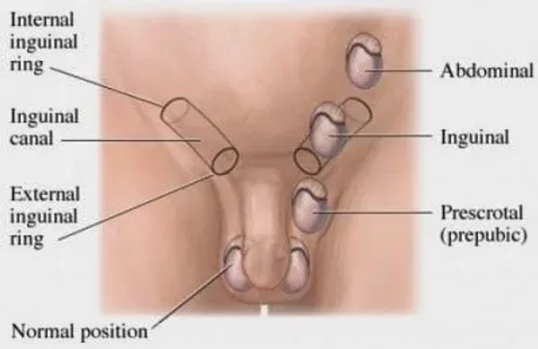 Desctended Testicals in Dogs