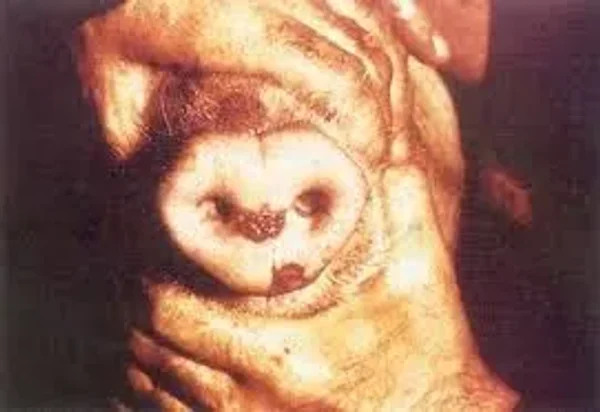 Vesicular stomatitis is an acute viral vesicular disease of cattle, horses, deer and pigs (and occasionally humans).